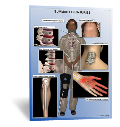 Injuries Overview